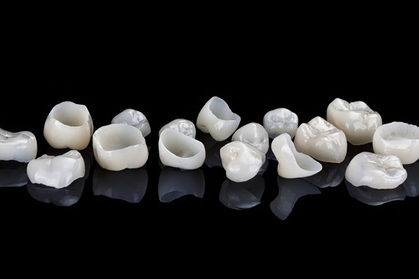 Can An Implant Crown Be Replaced?